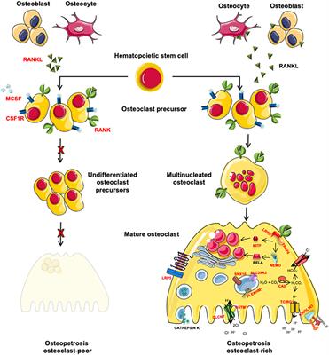 One Disease, Many Genes: Implications for the Treatment of Osteopetroses